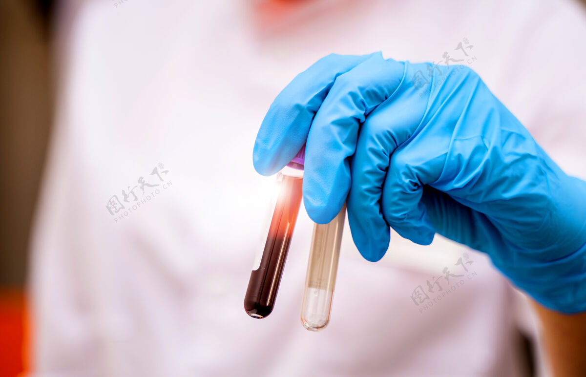 设备戴着蓝色手套的医生手里拿着一根装有血样的管子特写化学技术